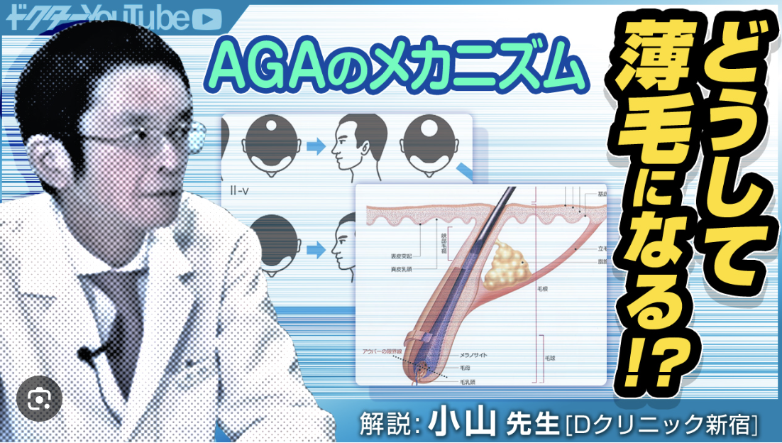AGAのメカニズムを専門家・小山太郎先生が解説！