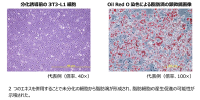 脂肪細胞の産生を促進させる効果を発見