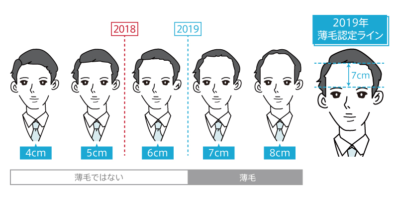 その髪の状態は要注意！？  令和版薄毛の境界線　薄毛認定ラインは「眉上7cm」 10月20日”頭髪の日” にあわせて　全国の「頭髪事情」を発表！