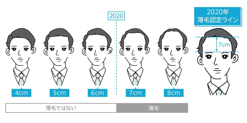 10月20日（火）は頭髪の日 【薄毛の境界線】今年も“眉上７cm” 　薄毛に最も厳しい県は「栃木県」、最も寛容な県は「秋田県」！