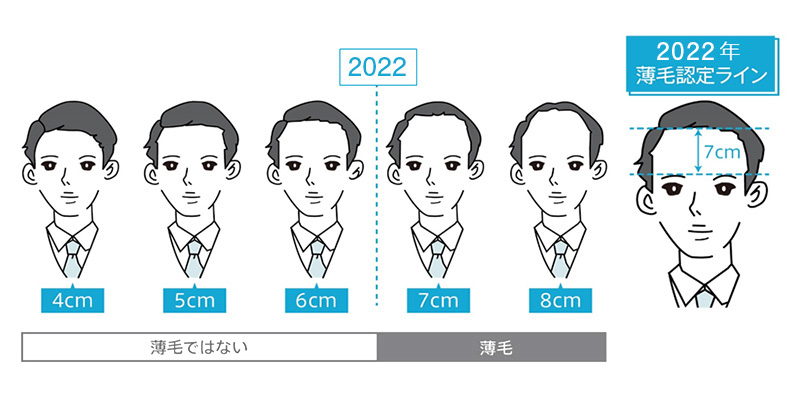 高年収ほど薄毛に厳しい傾向！？年収増すほど薄毛の境界線狭まる  全国4,700名回答「2022年版 薄毛の境界線」発表 2022年6月22日（水）から薄毛対策キャンペーンを実施中