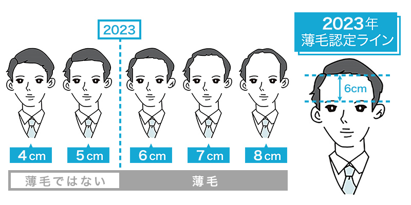 薄毛の境界線に激震！？薄毛の認定ラインが7cmから6cmに おでこに指4本収まれば薄毛に認定 全国4,700名が回答「2023年版　薄毛の境界線」発表 薄毛に厳しい都道府県No.１は兵庫県