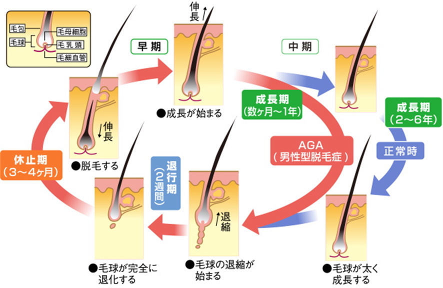 メカニズム