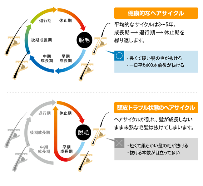 ヘアサイクルの乱れ