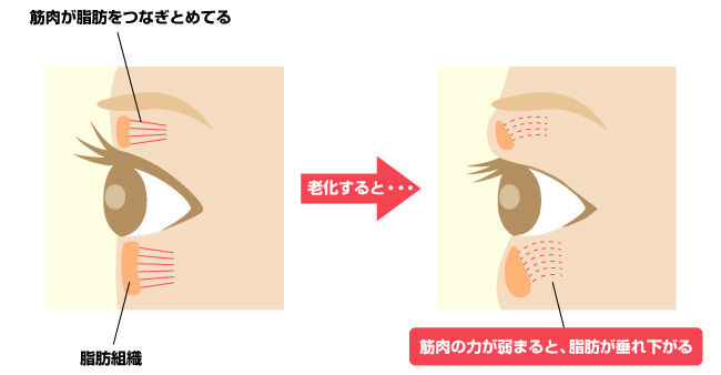 老化は目の周りからやってくる