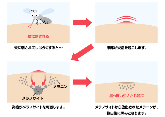 ブヨ 噛まれた跡