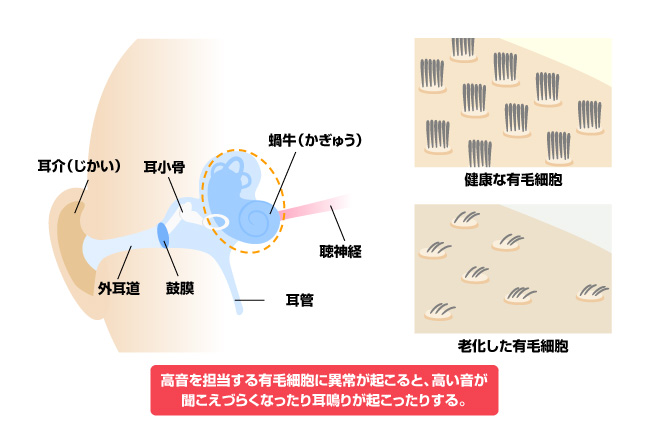 感覚細胞の老化が原因かも！