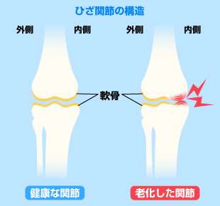 カチカチ同士ではお互いに負傷