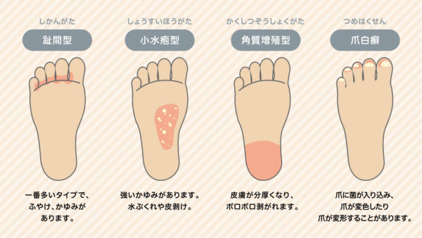 同一の ビクター コークス 濡れ た 靴 かゆい ケープ 統治可能 ブース