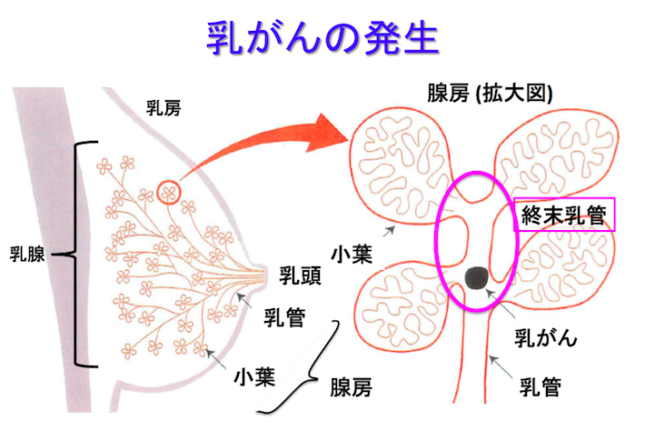 乳がんってどうしてできるの？ その症状は？