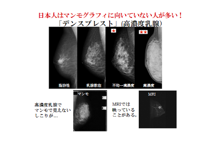資料提供：NPO法人乳がん画像診断ネットワーク