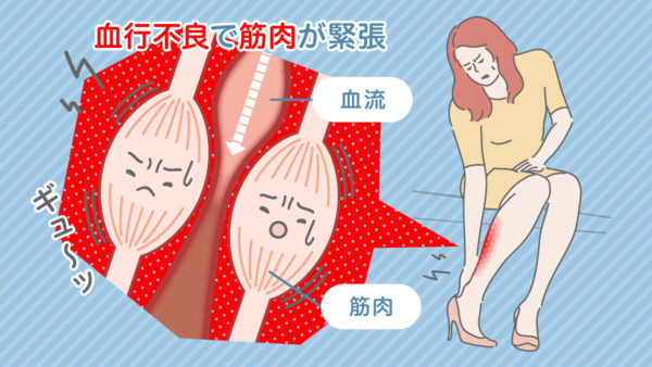 血行不良で筋肉が緊張