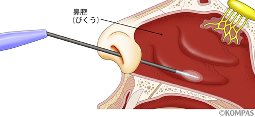 投薬治療や手術によって鼻づまりを解消