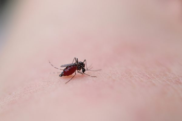 通称「蚊アレルギー」、蚊刺（ぶんし）過敏症とは？