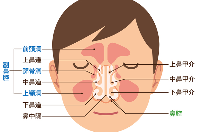 鼻の横の「副鼻腔」に膿が溜まる