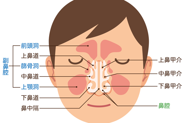 膿が溜まって顔が重くなる 蓄膿症になる原因とは アンファーからだエイジング 専門ドクター監修