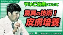 やけど治療の最新事情を聖マリアンナ医科大学の井上肇先生が解説！