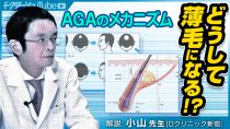 AGAのメカニズムを専門家・小山太郎先生が解説！